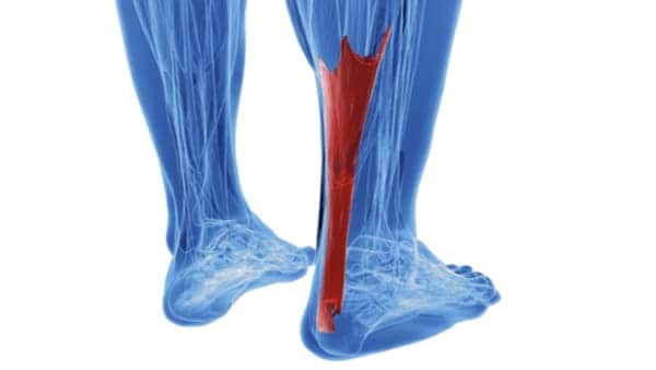 Webinar | Pathologies tendon d’Achille et chaîne postérieure