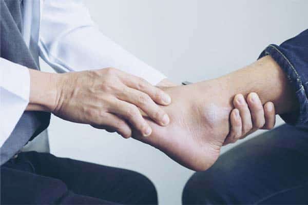 Ligamentoplastie de cheville sous arthroscopie : quels en sont les avantages ?